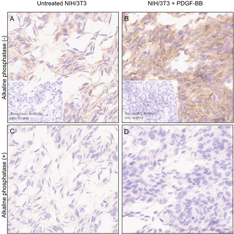 Immunohistochemistry (Formalin/PFA-fixed paraffin-embedded sections) - Anti-ATP citrate lyase (phospho S455) antibody [EPR31107-40] (AB327419)