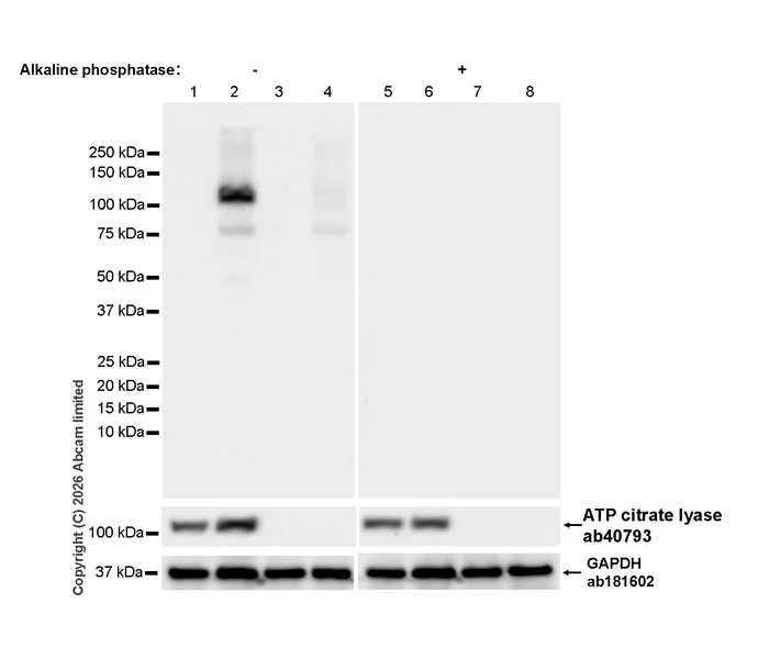 Western blot - Anti-ATP citrate lyase (phospho S455) antibody [EPR31107-40] (AB327419)