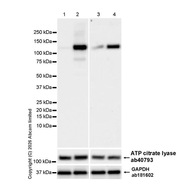 Western blot - Anti-ATP citrate lyase (phospho S455) antibody [EPR31107-40] (AB327419)