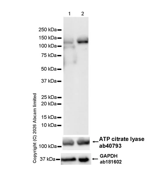 Western blot - Anti-ATP citrate lyase (phospho S455) antibody [EPR31107-40] (AB327419)