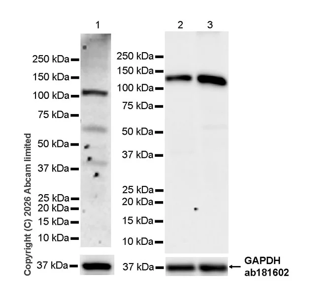 Western blot - Anti-ATP citrate lyase (phospho S455) antibody [EPR31107-40] (AB327419)