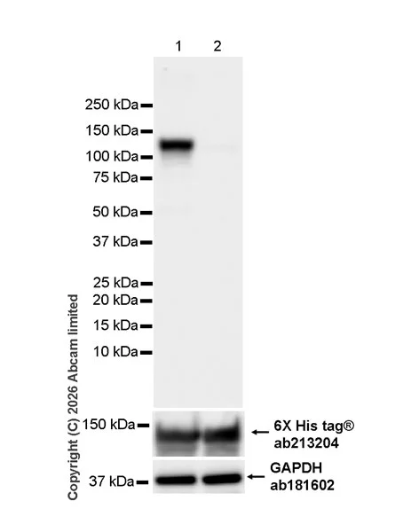 Western blot - Anti-ATP citrate lyase (phospho S455) antibody [EPR31107-40] (AB327419)