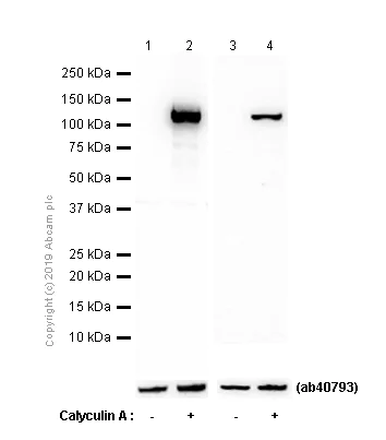Western blot - Anti-ATP citrate lyase (phospho T447 + S451) antibody [EP737Y] - BSA and Azide free (AB247346)