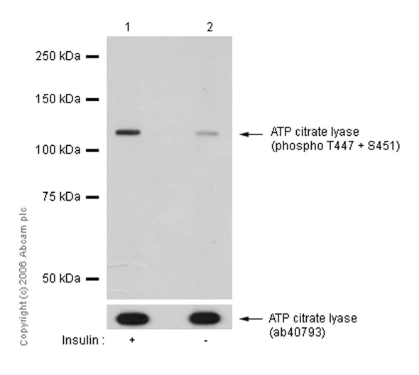 Western blot - Anti-ATP citrate lyase (phospho T447 + S451) antibody [EP737Y] - BSA and Azide free (AB247346)