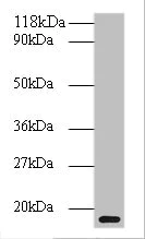 Western blot - Anti-ATP-dependent Clp protease adapter protein ClpS antibody (AB193643)