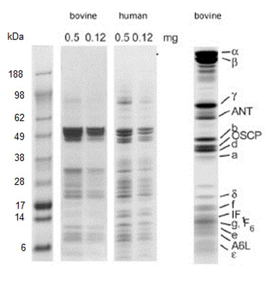 Western blot - ATP Synthase Immunocapture Kit (AB109715), expandable thumbnail