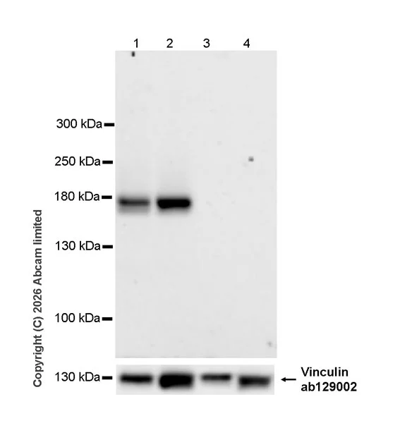 Western blot - Anti-ATP10B antibody [MJF-D29757-57] - BSA and Azide free (AB326051)