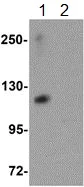 Western blot - Anti-ATP11A antibody (AB105351)