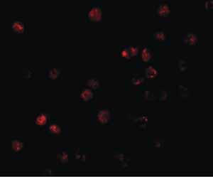 Immunocytochemistry - Anti-ATP11B antibody (AB105377)