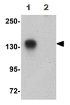 Western blot - Anti-ATP11B antibody (AB105377)