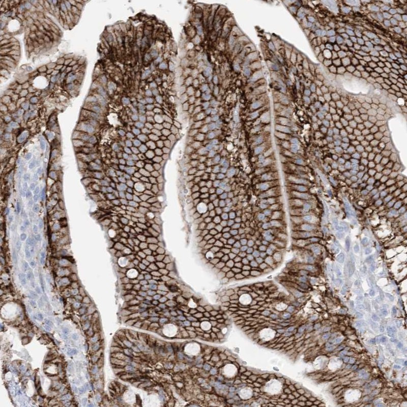 Immunohistochemistry (Formalin/PFA-fixed paraffin-embedded sections) - Anti-ATP11C antibody (AB262923)