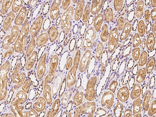 Immunohistochemistry (Formalin/PFA-fixed paraffin-embedded sections) - Anti-ATP12A antibody (AB275647)