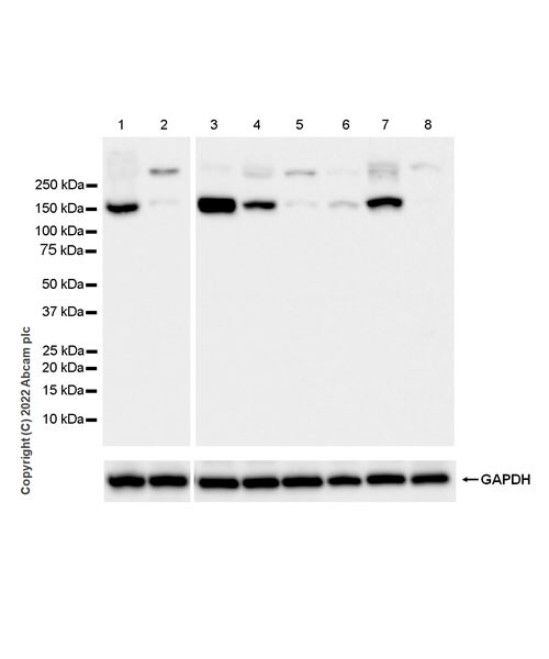 Western blot - Anti-ATP13A2 antibody [EPR26835-63] (AB303528), expandable thumbnail