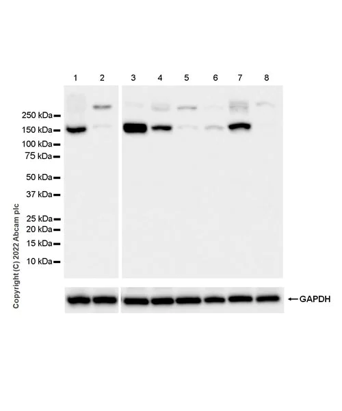 Western blot - Anti-ATP13A2 antibody [EPR26835-63] (AB303528)