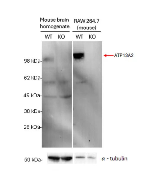 Western blot - Anti-ATP13A2 antibody [MJF-D29756-103] (AB327344)