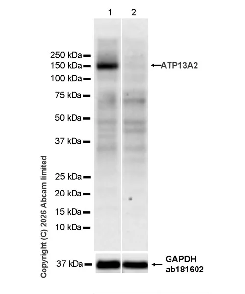 Western blot - Anti-ATP13A2 antibody [MJF-D29756-103] (AB327344)