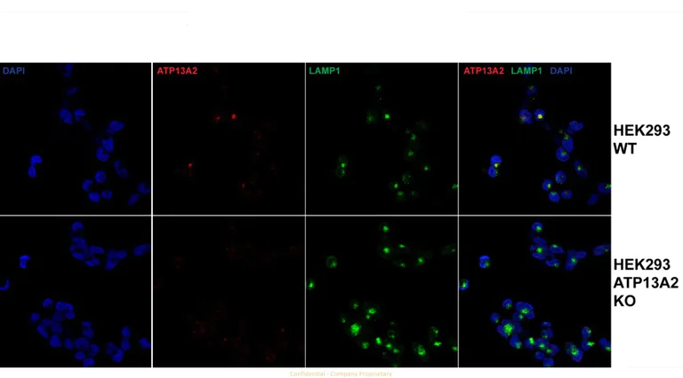 Immunocytochemistry/ Immunofluorescence - Anti-ATP13A2 antibody [MJF-D29756-28] (AB322735)