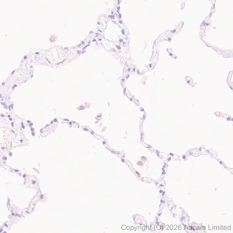 Immunohistochemistry (Formalin/PFA-fixed paraffin-embedded sections) - Anti-ATP13A2 antibody [MJF-D29756-28] (AB322735)