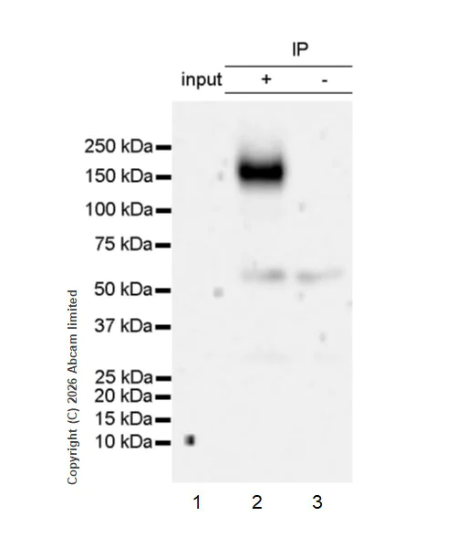 Immunoprecipitation - Anti-ATP13A2 antibody [MJF-D29756-28] (AB322735)