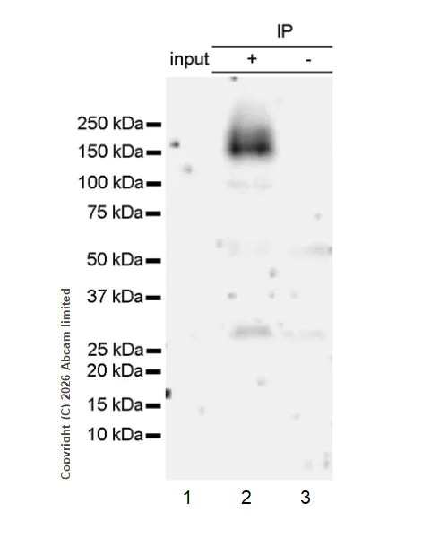 Immunoprecipitation - Anti-ATP13A2 antibody [MJF-D29756-28] (AB322735)