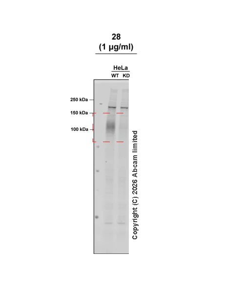 Western blot - Anti-ATP13A2 antibody [MJF-D29756-28] (AB322735)