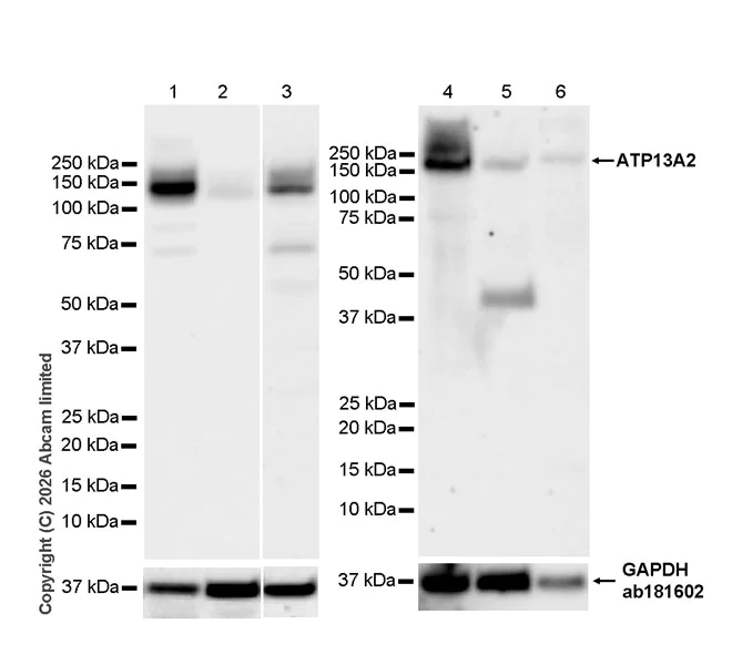 Western blot - Anti-ATP13A2 antibody [MJF-D29756-28] (AB322735)