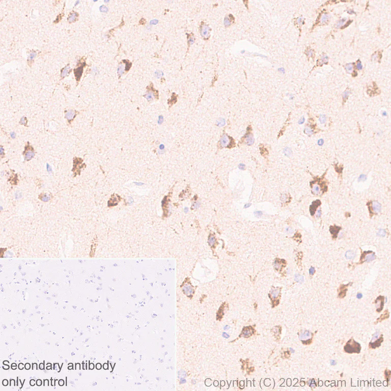 Immunohistochemistry (Formalin/PFA-fixed paraffin-embedded sections) - Anti-ATP13A2 antibody [MJF-D29756-28] - BSA and Azide free (AB326368)