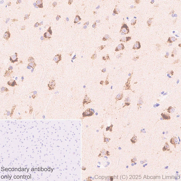 Immunohistochemistry (Formalin/PFA-fixed paraffin-embedded sections) - Anti-ATP13A2 antibody [MJF-D29756-28] - BSA and Azide free (AB326368)