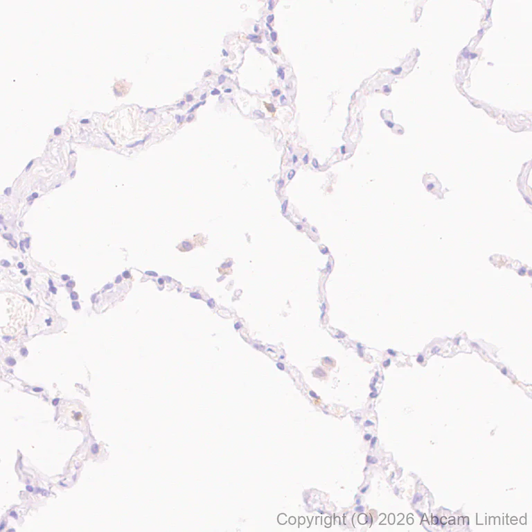 Immunohistochemistry (Formalin/PFA-fixed paraffin-embedded sections) - Anti-ATP13A2 antibody [MJF-D29756-28] - BSA and Azide free (AB326368)