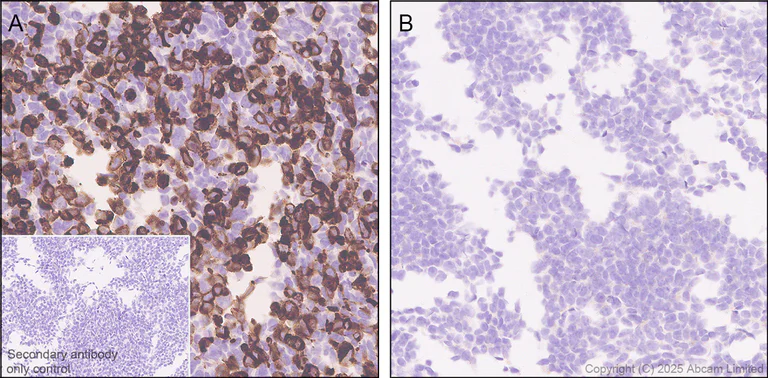 Immunohistochemistry (Formalin/PFA-fixed paraffin-embedded sections) - Anti-ATP13A2 antibody [MJF-D29756-28] - BSA and Azide free (AB326368)