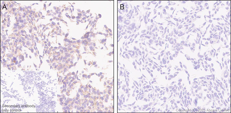 Immunohistochemistry (Formalin/PFA-fixed paraffin-embedded sections) - Anti-ATP13A2 antibody [MJF-D29756-28] - BSA and Azide free (AB326368)