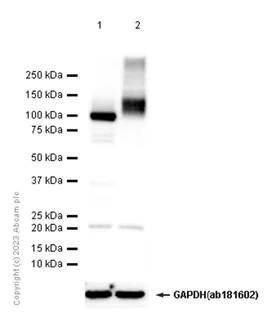 Western blot - Anti-ATP1A2 antibody [EPR11896(B)] (AB166888)