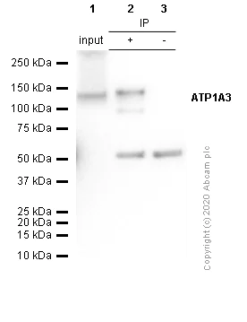 Immunoprecipitation - Anti-ATP1A3 antibody [EPR14137] - N-terminal (AB182572)