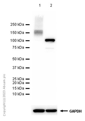 Western blot - Anti-ATP1A3 antibody [EPR14137] - N-terminal (AB182572)