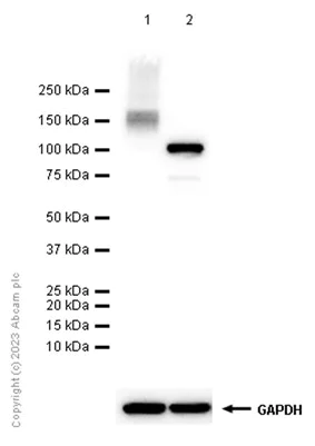 Western blot - Anti-ATP1A3 antibody [EPR14137] - N-terminal (AB182572)