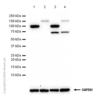 Western blot - Anti-ATP1A3 antibody [EPR14137] - N-terminal (AB182572)