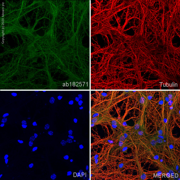 Immunocytochemistry/ Immunofluorescence - Anti-ATP1A3 antibody [EPR14138] (AB182571), expandable thumbnail