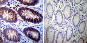Immunohistochemistry (Formalin/PFA-fixed paraffin-embedded sections) - Anti-ATP1A3 antibody [XVIF9-G10] (AB2826)