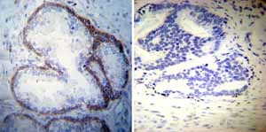 Immunohistochemistry (Formalin/PFA-fixed paraffin-embedded sections) - Anti-ATP1A3 antibody [XVIF9-G10] (AB2826), expandable thumbnail