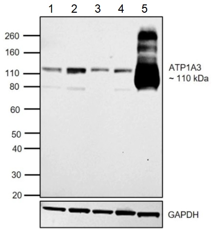 Western blot - Anti-ATP1A3 antibody [XVIF9-G10] (AB2826), expandable thumbnail