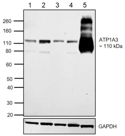 Western blot - Anti-ATP1A3 antibody [XVIF9-G10] (AB2826)