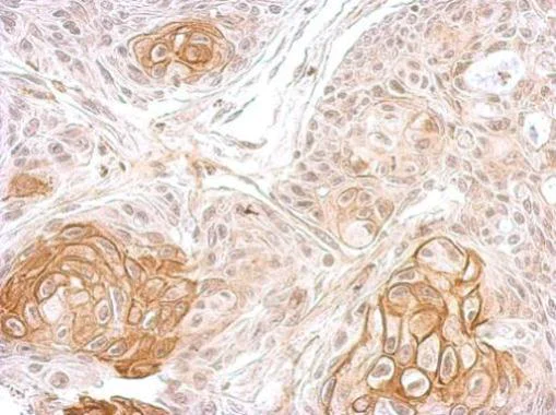 Immunohistochemistry (Formalin/PFA-fixed paraffin-embedded sections) - Anti-ATP1B1 antibody (AB96292)