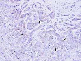 Immunohistochemistry (Formalin/PFA-fixed paraffin-embedded sections) - Anti-ATP1B1 antibody (AB96292)