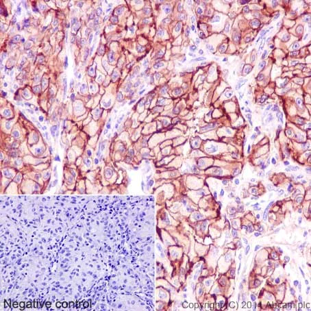 Immunohistochemistry (Formalin/PFA-fixed paraffin-embedded sections) - Anti-ATP1B1 antibody [EPR12195] (AB193669)