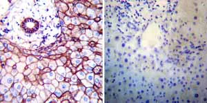 Immunohistochemistry (Formalin/PFA-fixed paraffin-embedded sections) - Anti-ATP1B1 antibody [M17-P5-F11] (AB2873)