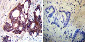 Immunohistochemistry (Formalin/PFA-fixed paraffin-embedded sections) - Anti-ATP1B1 antibody [M17-P5-F11] (AB2873)