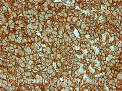 Immunohistochemistry (Formalin/PFA-fixed paraffin-embedded sections) - Anti-ATP1B1 antibody [M17-P5-F11] (AB2873)