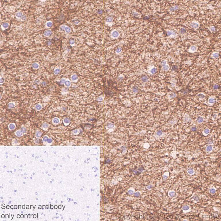 Immunohistochemistry (Formalin/PFA-fixed paraffin-embedded sections) - Anti-ATP1B2 antibody [EPR15460(B)] (AB185210)