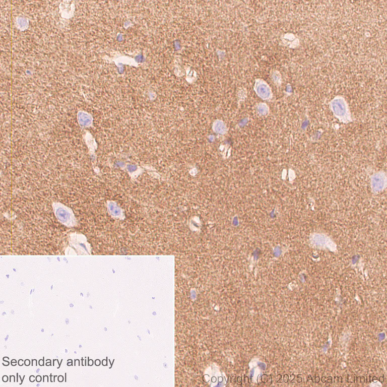 Immunohistochemistry (Formalin/PFA-fixed paraffin-embedded sections) - Anti-ATP1B2 antibody [EPR15460(B)] - BSA and Azide free (AB250809)