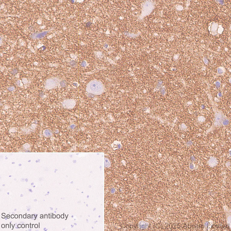 Immunohistochemistry (Formalin/PFA-fixed paraffin-embedded sections) - Anti-ATP1B2 antibody [EPR15461(B)] - C-terminal (AB185207)